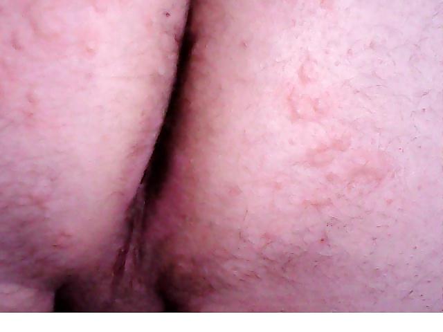 14P Cbt