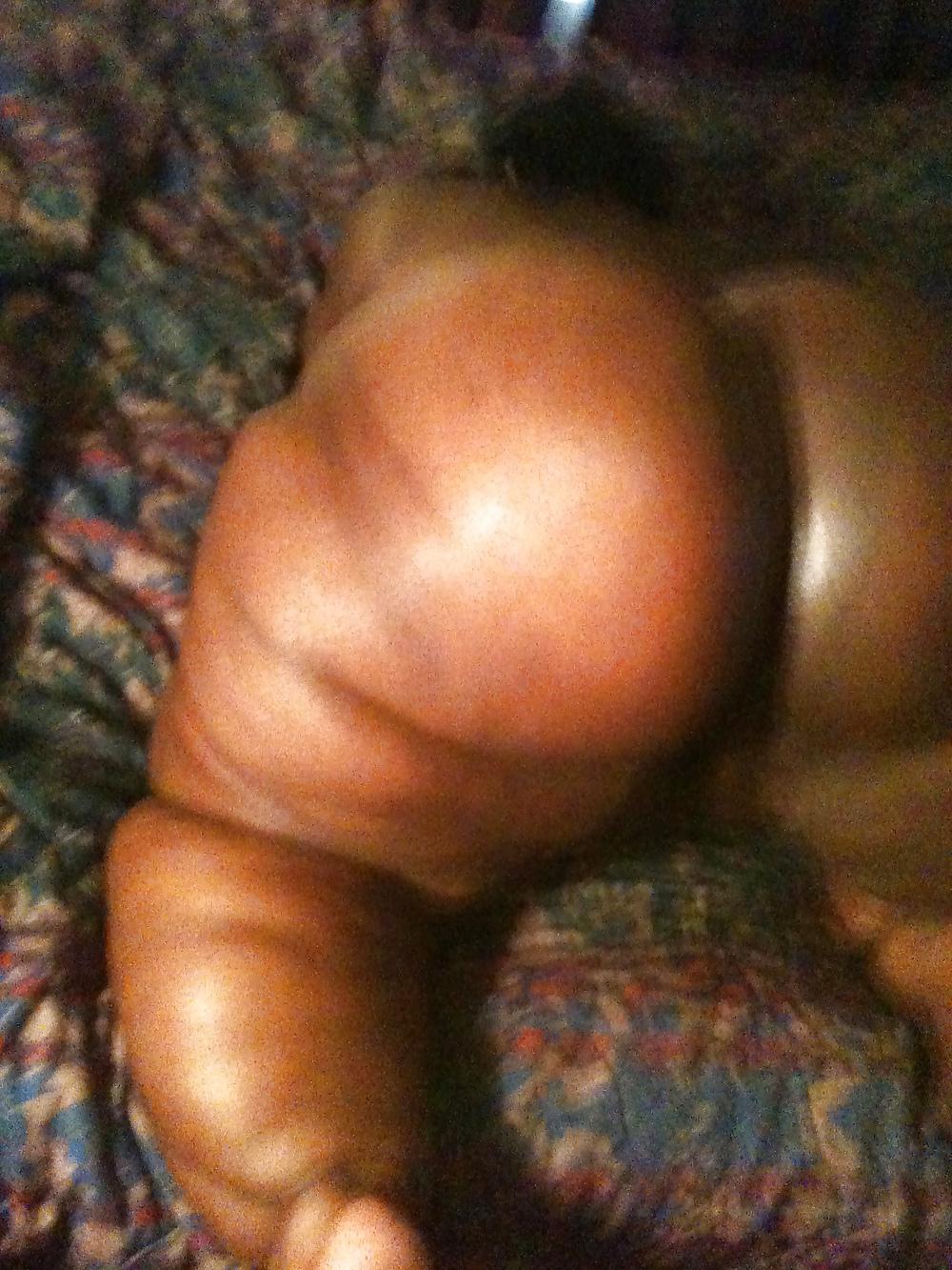 16P Fast Nut