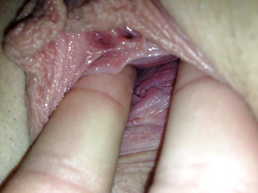 15P Married sex