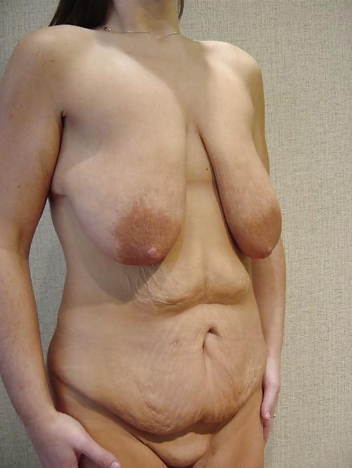 25P Floppy Saggy Tits