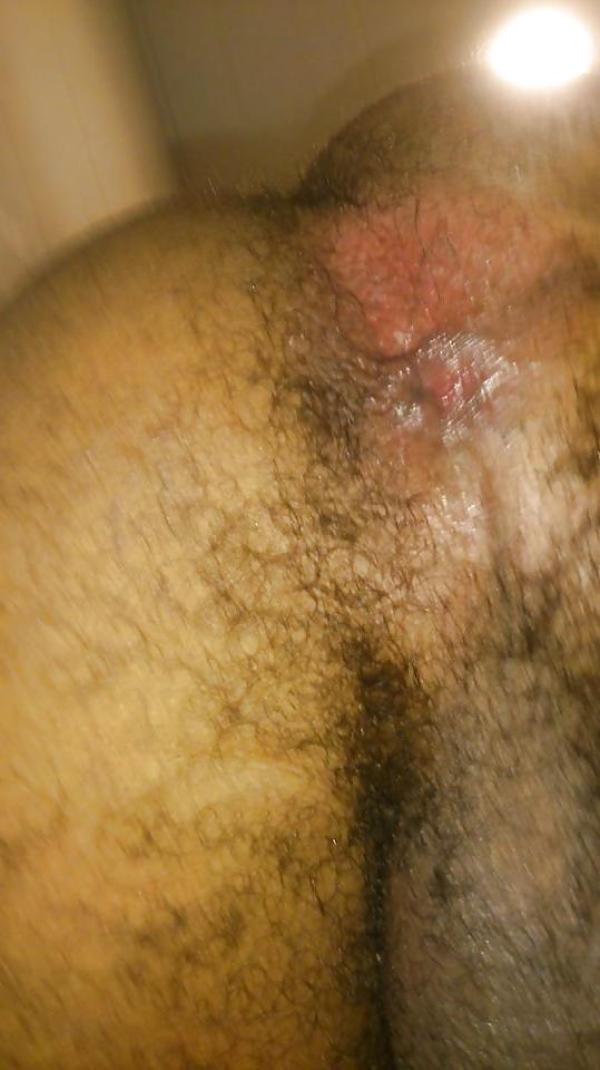 5P My ass hole