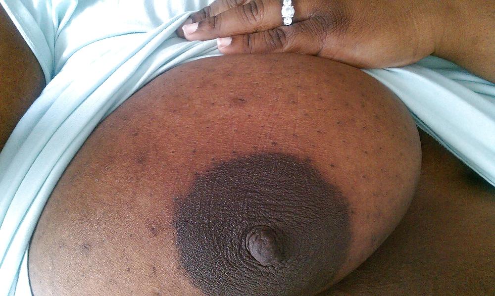 7P More breast