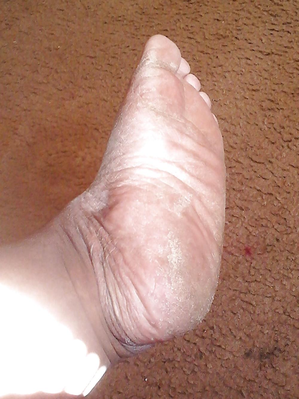 6P TITZ GALURE