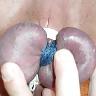 25P Older CBT Pics