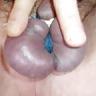 25P Older CBT Pics