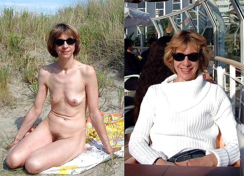 20P Before after 307 ( small tits special)