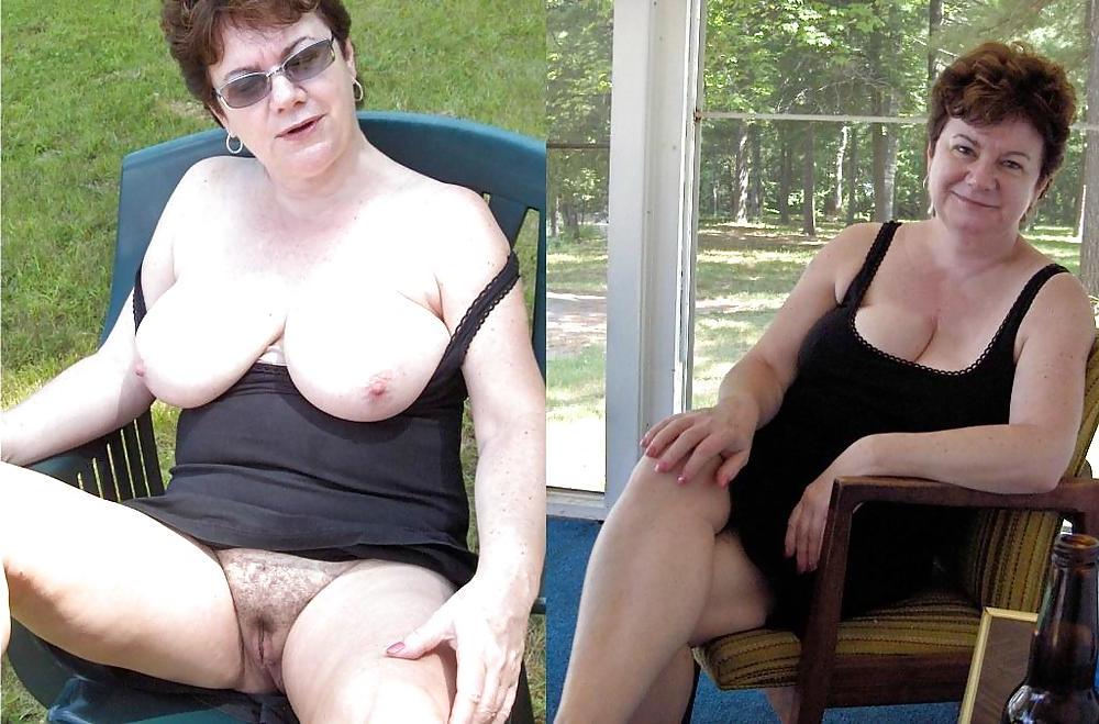 20P Before after 313 (saggy tits special)