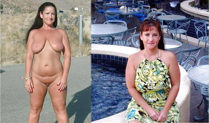 20P Before after 313 (saggy tits special)