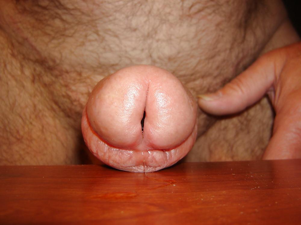25P My CBT