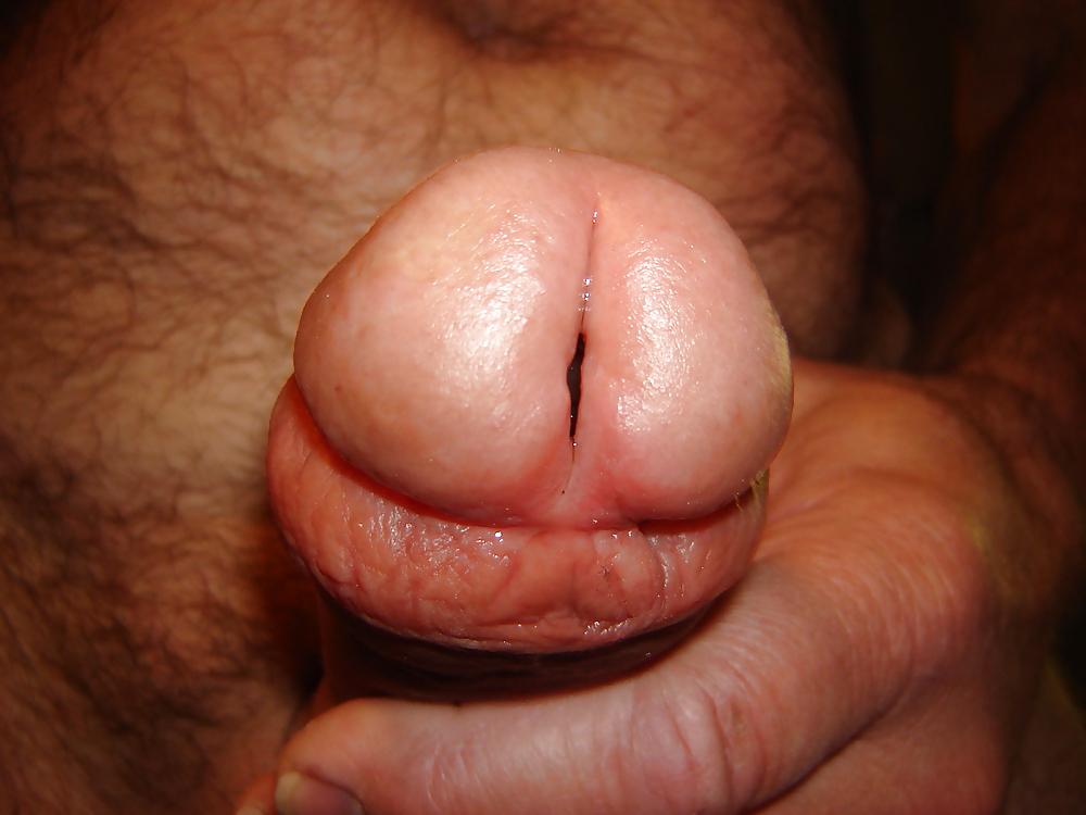 25P My CBT