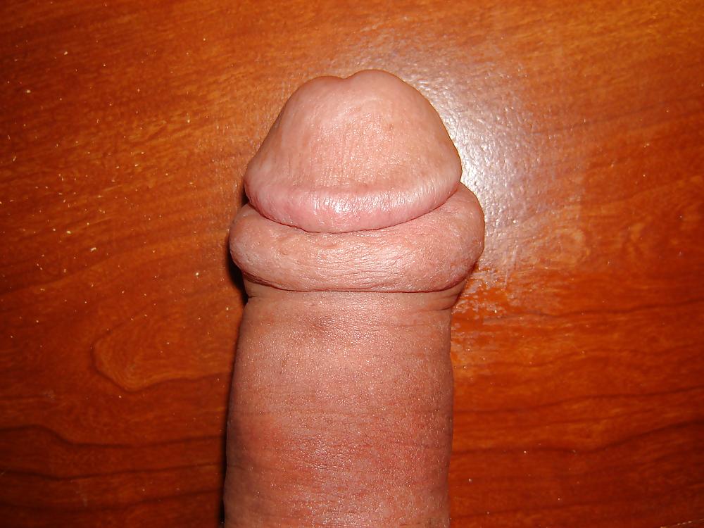 25P My CBT