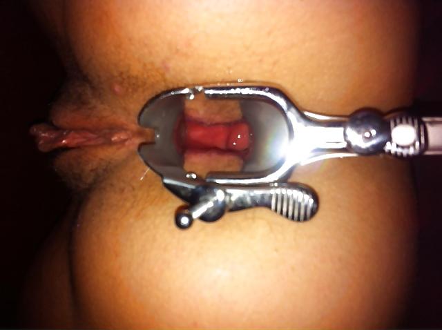 8P TOPBICHE anal speculum opened ass