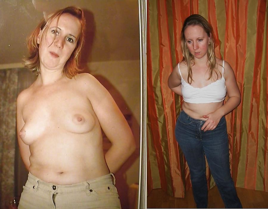 20P Before after 343 (Small tits special)