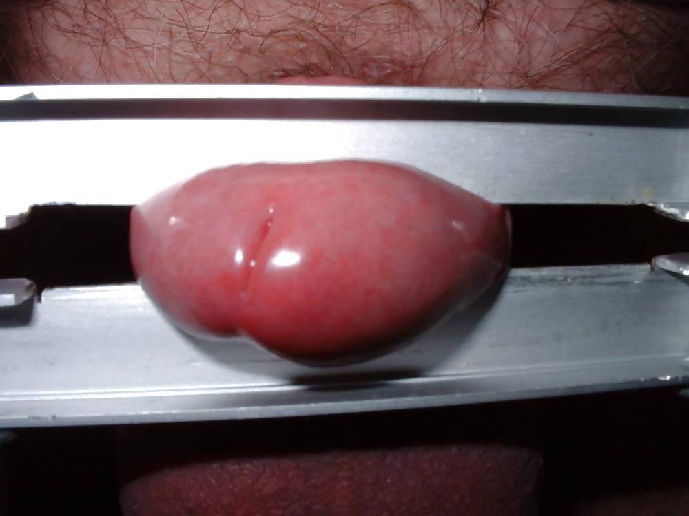 21P CBT