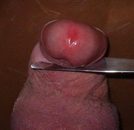 21P CBT