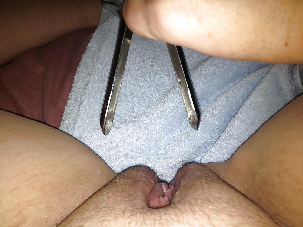 7P Speculum stretching