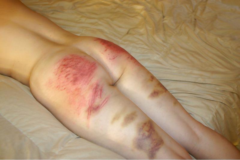 25P Spanked Asses 13