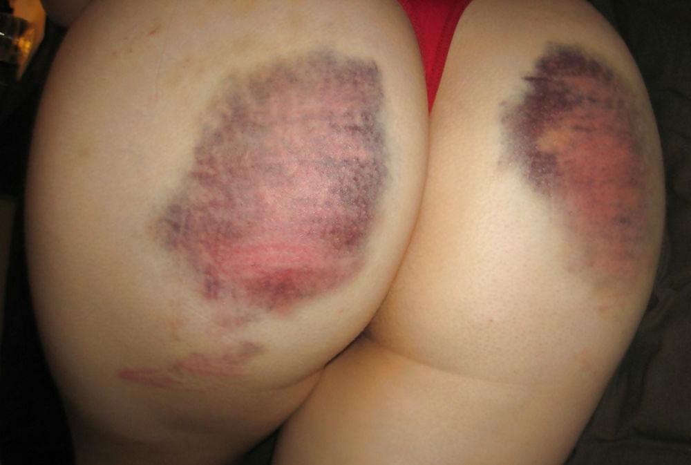 25P Spanked Asses 13