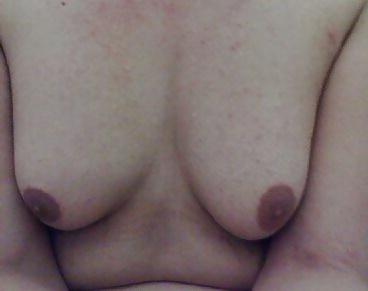 25P Nur Bilder davon