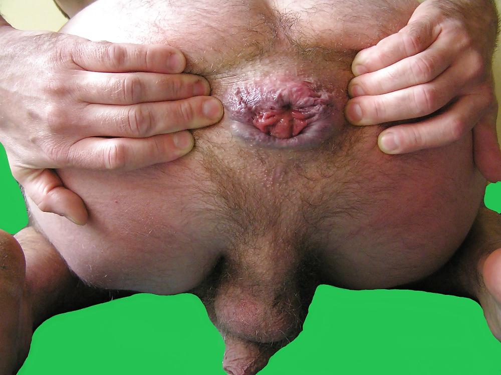 9P Gaping , prolapse ready man cunts