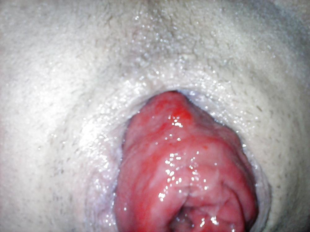 9P Gaping , prolapse ready man cunts