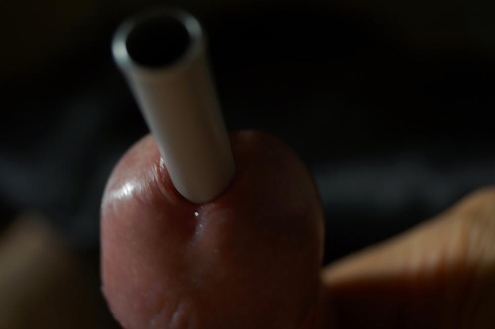 11P CBT insertion 