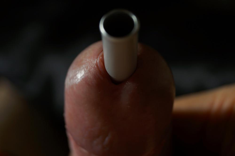 11P CBT insertion 