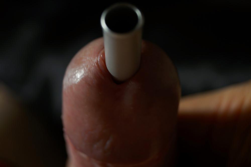 11P CBT insertion 