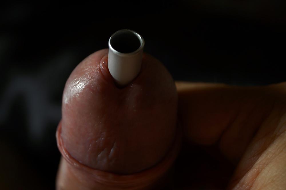 11P CBT insertion 