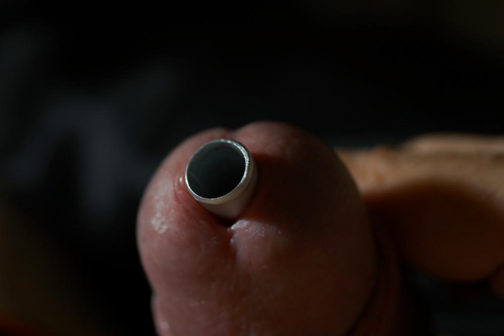11P CBT insertion 