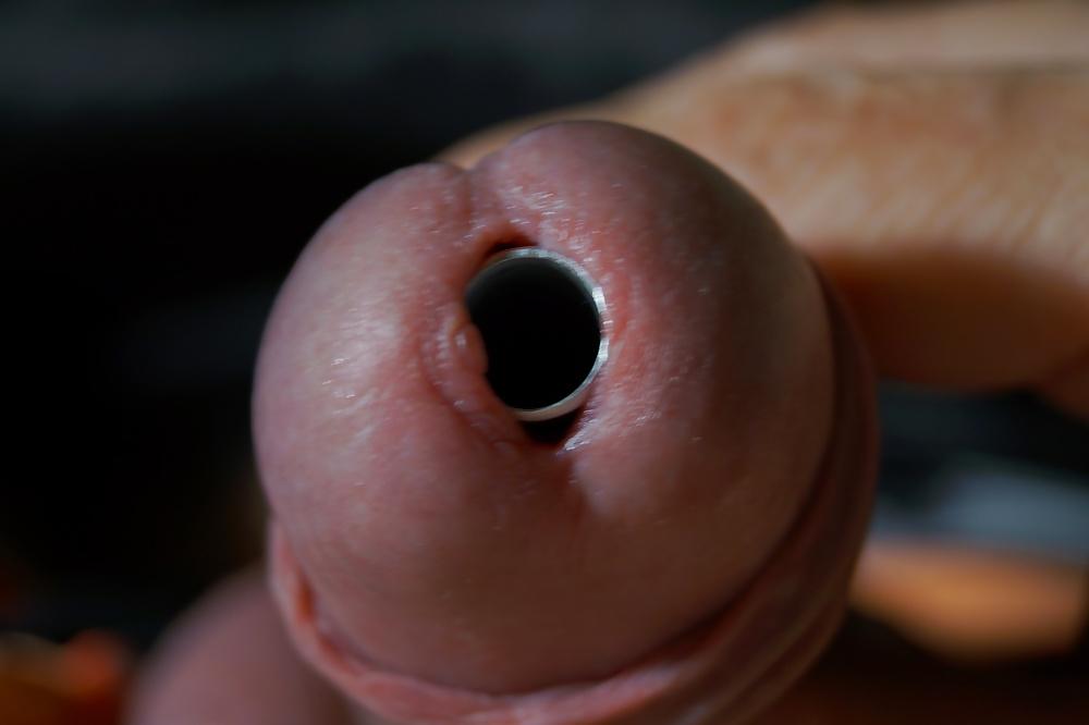 11P CBT insertion 