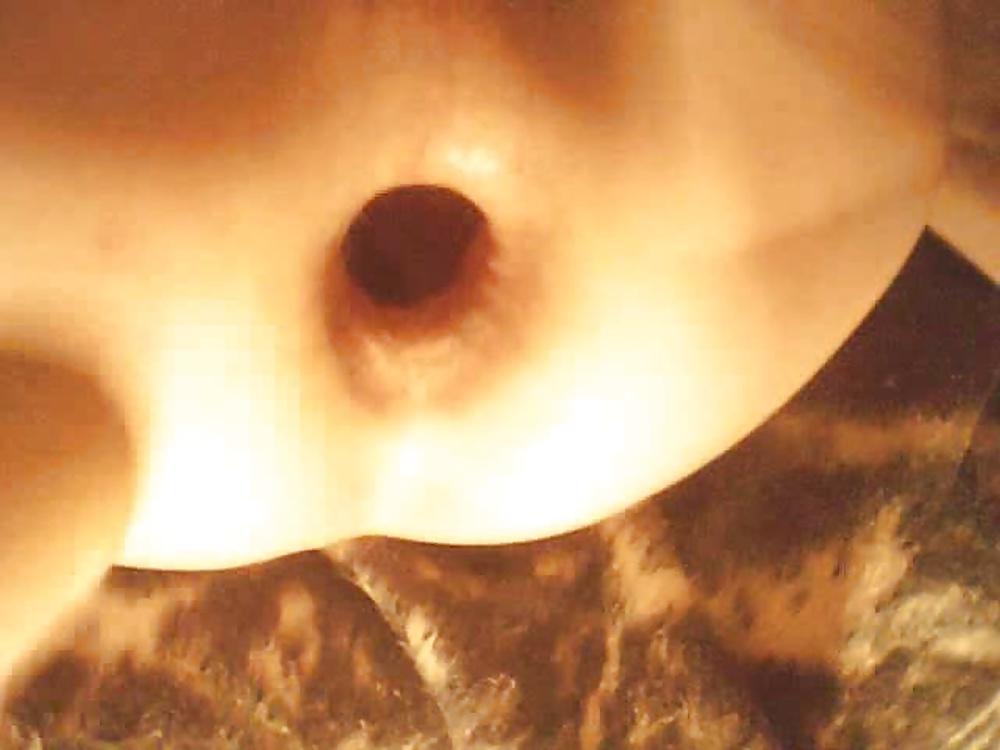 18P Wide-hole-spreading