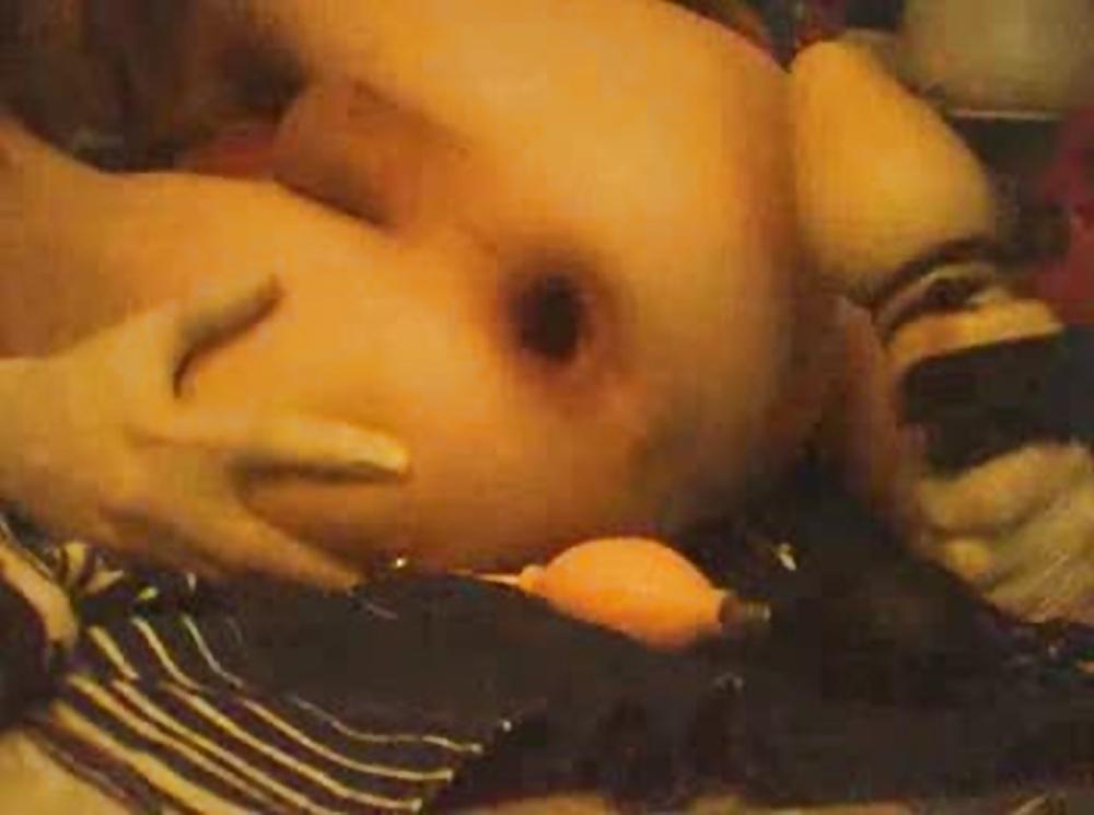 18P Wide-hole-spreading