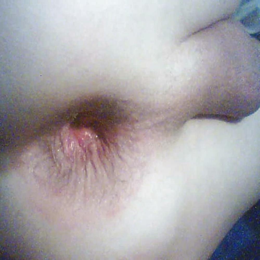 18P Wide-hole-spreading