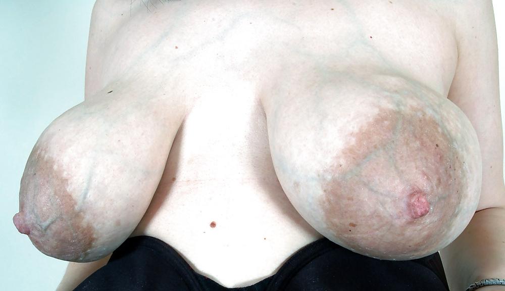 25P Big Nipples