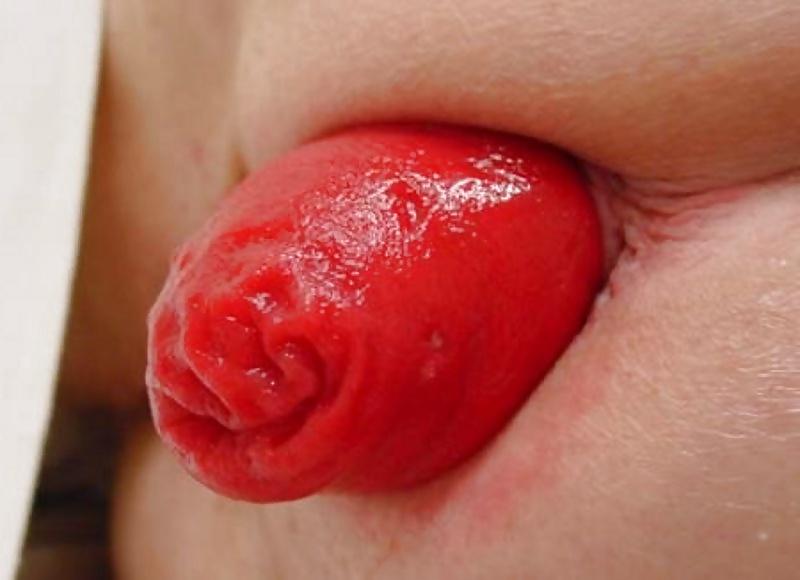 15P Prolasped Gaping and Spread Assholes-Open All Night #36