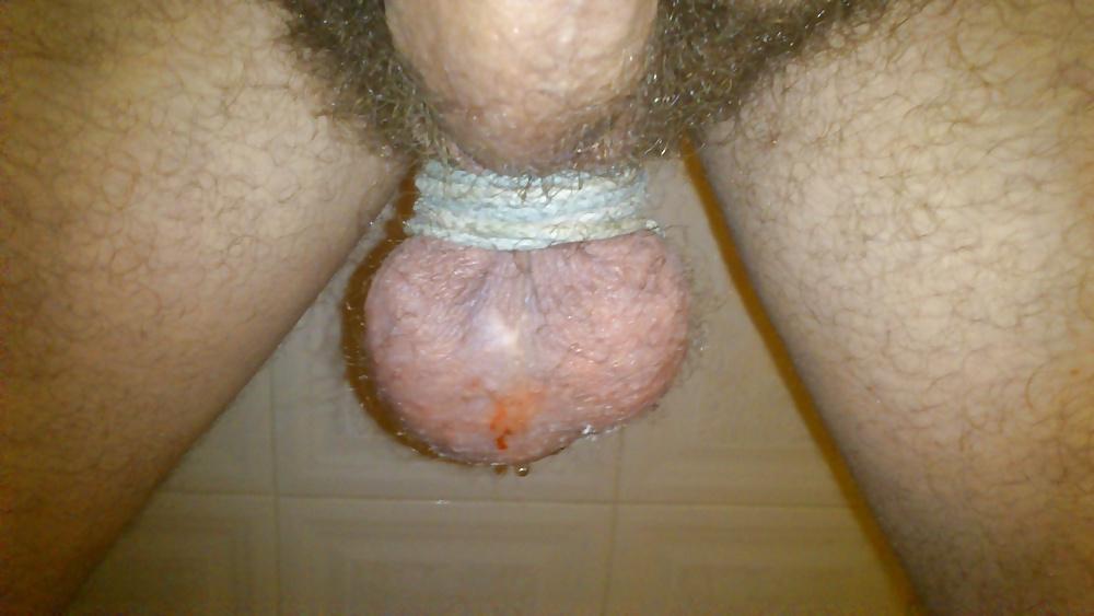 6P CBT extremo 2