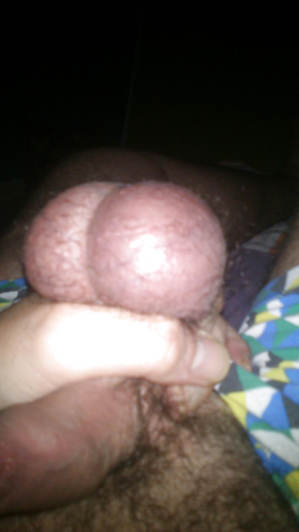 11P Cbt 