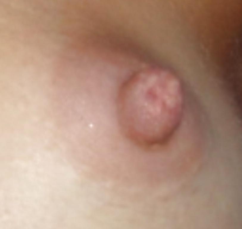25P Small Tits my wife