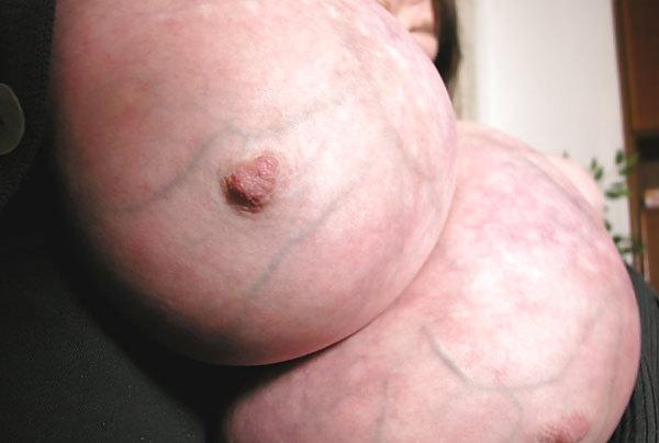 16P Huge Boobs 74