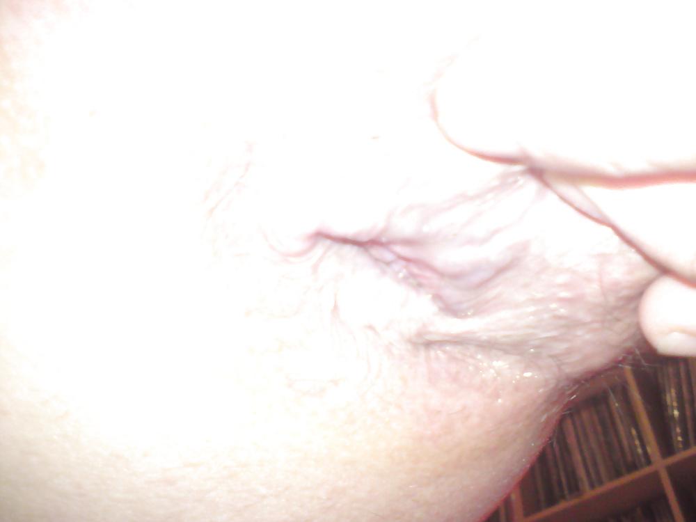 6P Open hole
