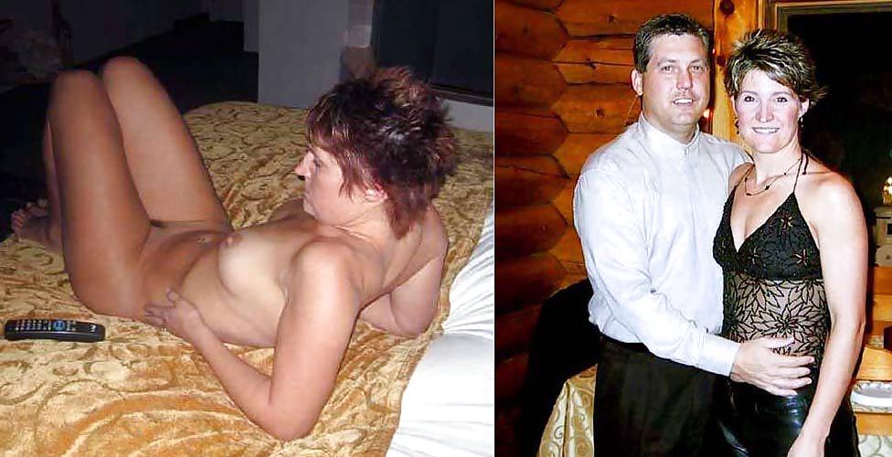 20P Before after 387 (small tits special)
