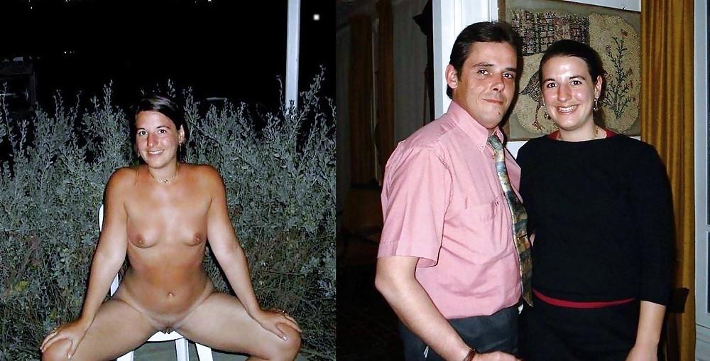 20P Before after 387 (small tits special)