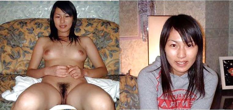 20P Before after 387 (small tits special)