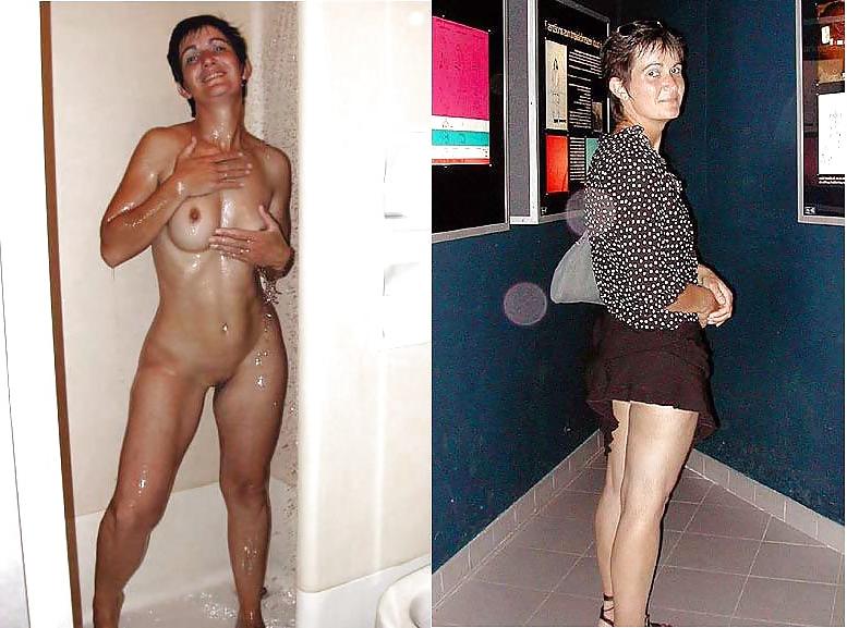 20P Before after 387 (small tits special)