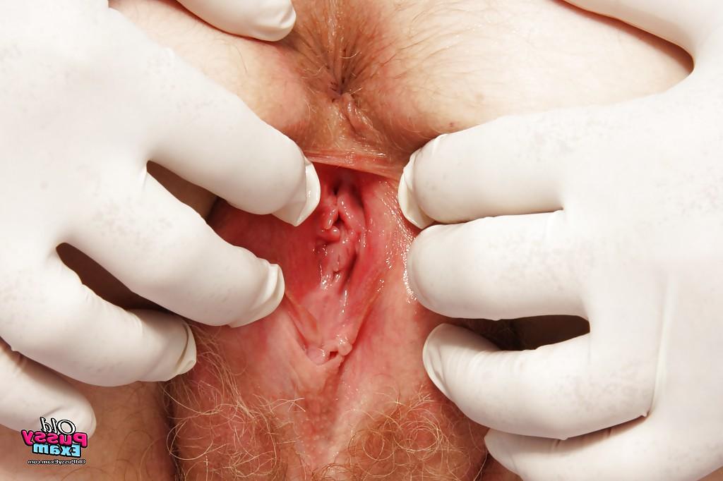 16P Fatty redhead mature lady with big tits gets her twat examed by gyno