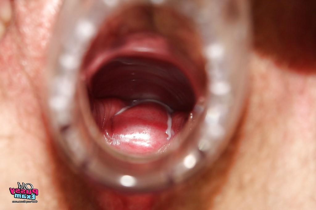 16P Chubby redhead granny masturbating her unshaven cunt in gyno office