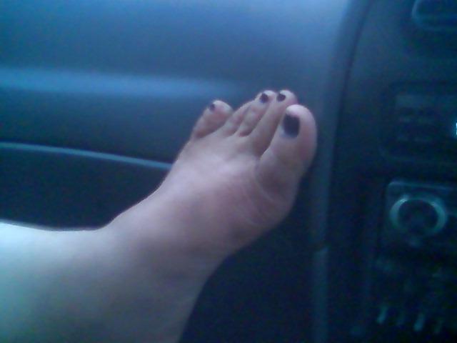 9P Egyptian feet