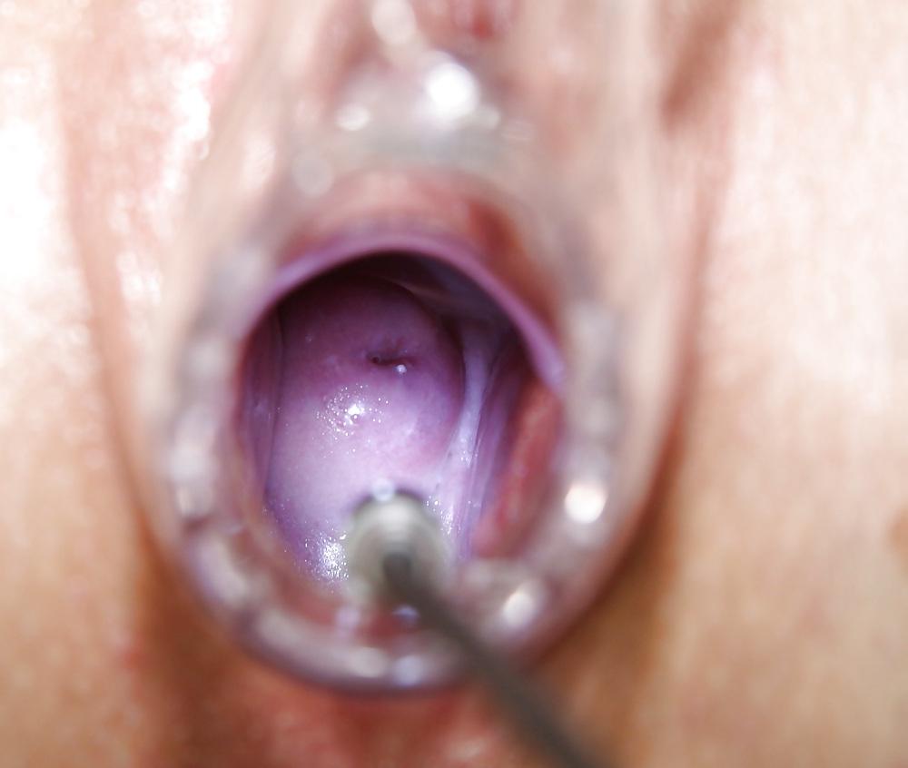 25P Speculum View in a pussy