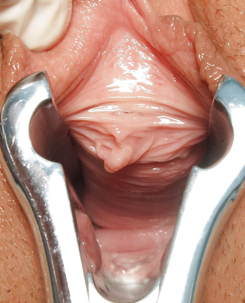 25P Speculum View in a pussy